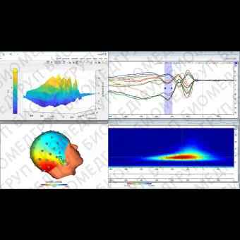 Программное обеспечение для ЭКГ Analyzer 2