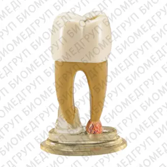 TOOTH MODEL RTYPE разборная модель зуба
