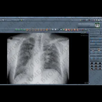 Программное обеспечение для системы архивации и передачи изображений NEXUS / PACS