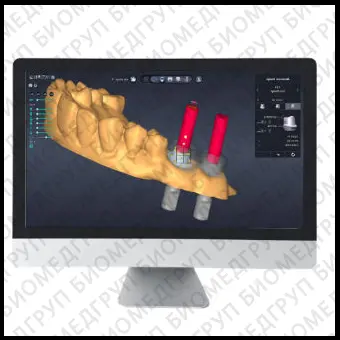 Медицинское программное обеспечение DentiqAbut