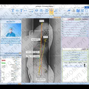 Программное обеспечение для МРТ mediCAD 3D Spine