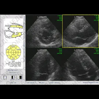 Программное обеспечение для ультразвуковых исследований Ecoestres
