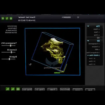 Медицинское программное обеспечение 3D