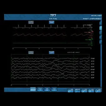 Медицинское программное обеспечение CNS Monitor