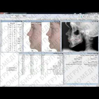 Программное обеспечение для медицинских снимков Dr. Ceph