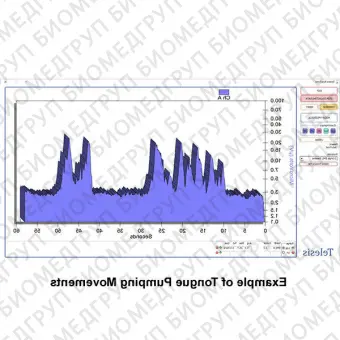 Медицинское программное обеспечение Telesis ST 9250ST