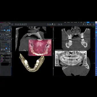 Программное обеспечение для обработки снимков зубов Planmeca Romexis 6.0