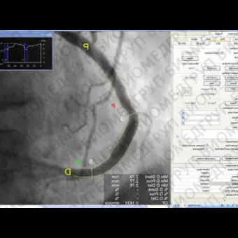 Программное обеспечение для ангиографии CAAS XA