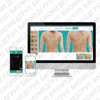 Программное обеспечение телемедицина Full Body Imaging/ Molematch / MoleMap