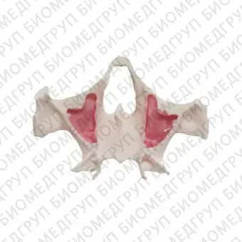 E36 точная анатомическая модель верхней челюсти для практики скуловых имплантов