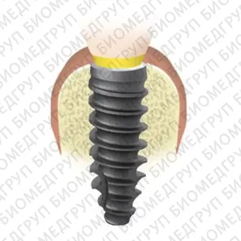Конический зубной имплантат MasterC