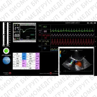 Медицинский симулятор для кардиологической хирургии CALIFIA 2.0