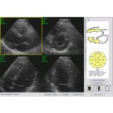 Программное обеспечение для ультразвуковых исследований Ecoestres